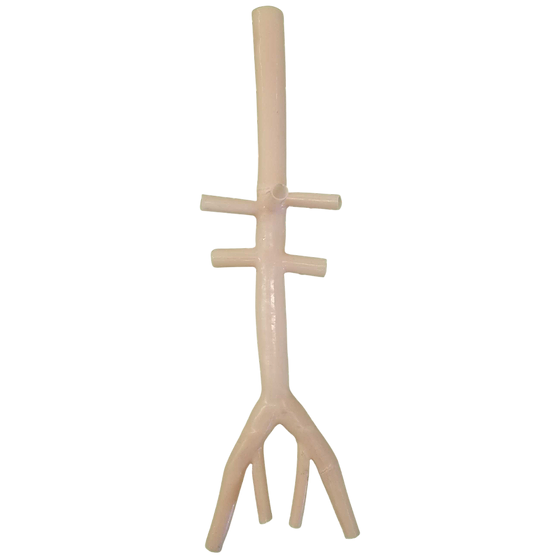 Veins of the Neck, Torso, and Abdomen